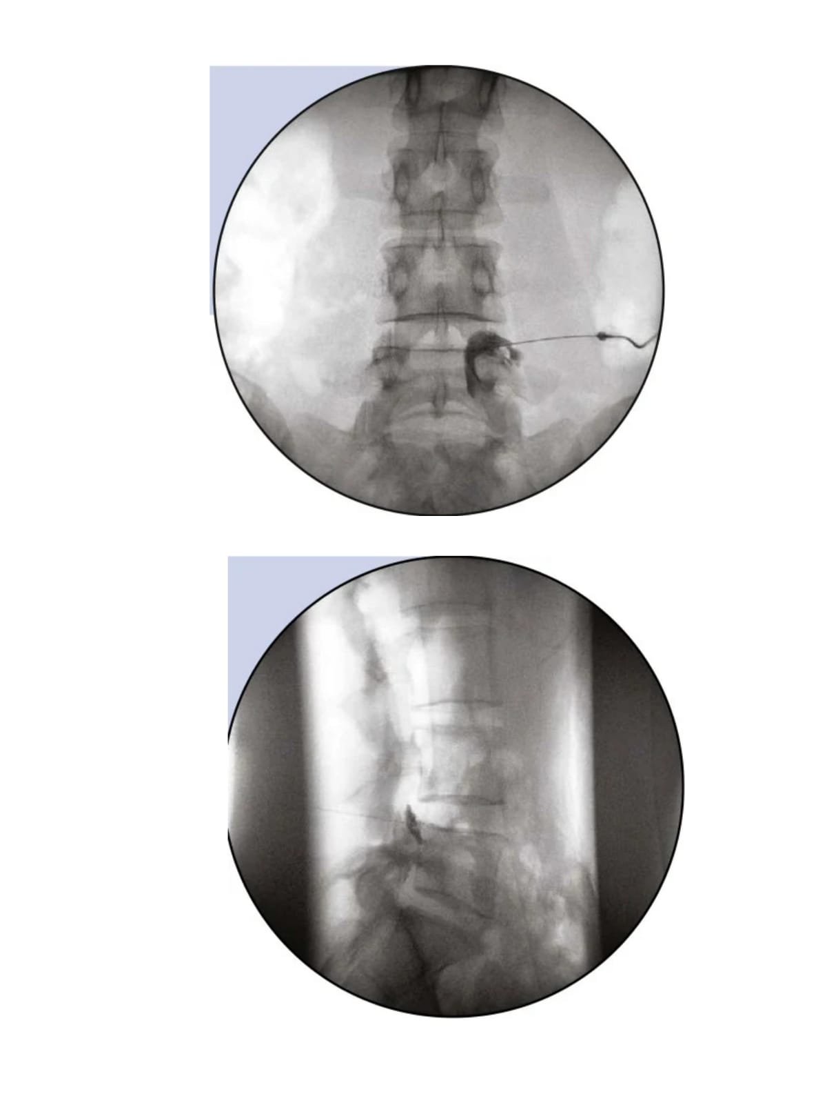 Imaging guided procedures-image-3