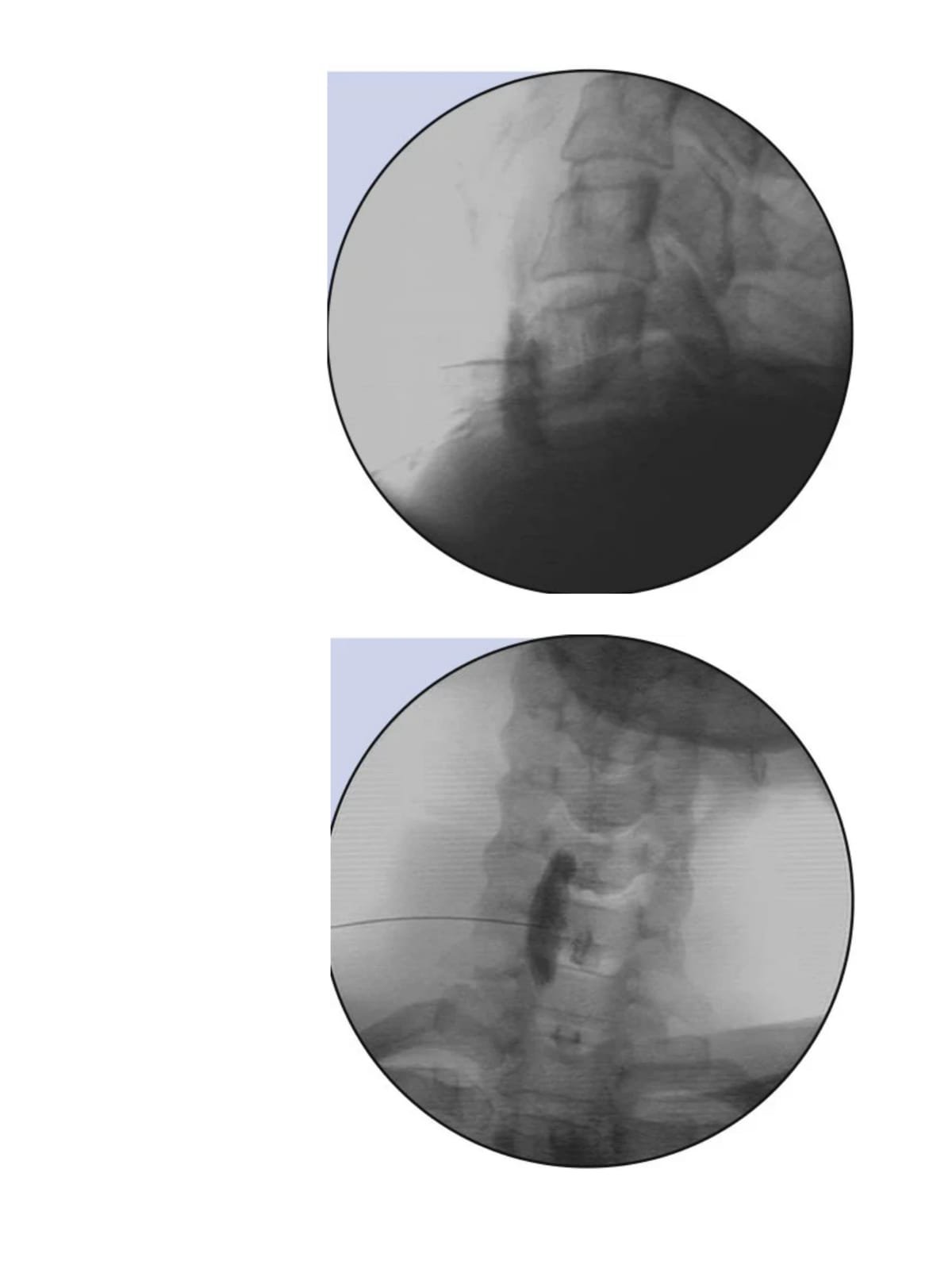 Imaging guided procedures-image-4